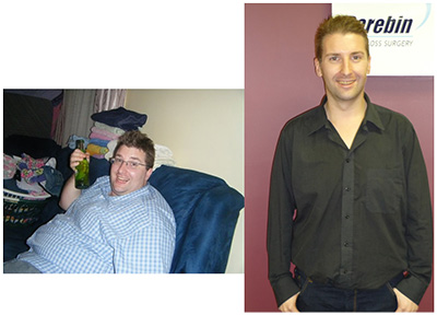 brads-success-before-after