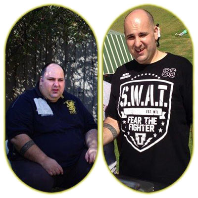 John before and after gastric sleeve surgery
